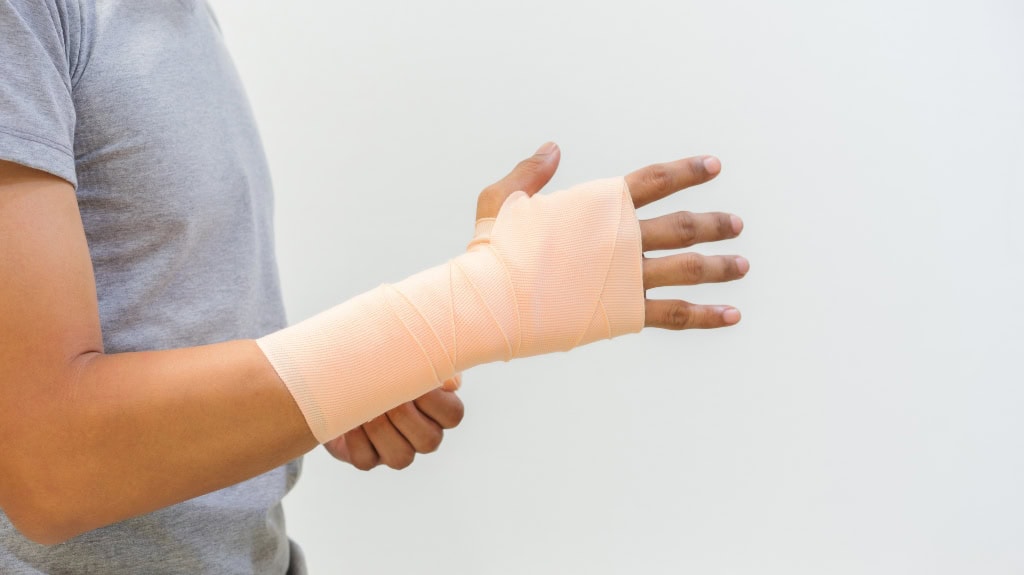 The 3 Most Common Types of Personal Injury Cases arm in a cast